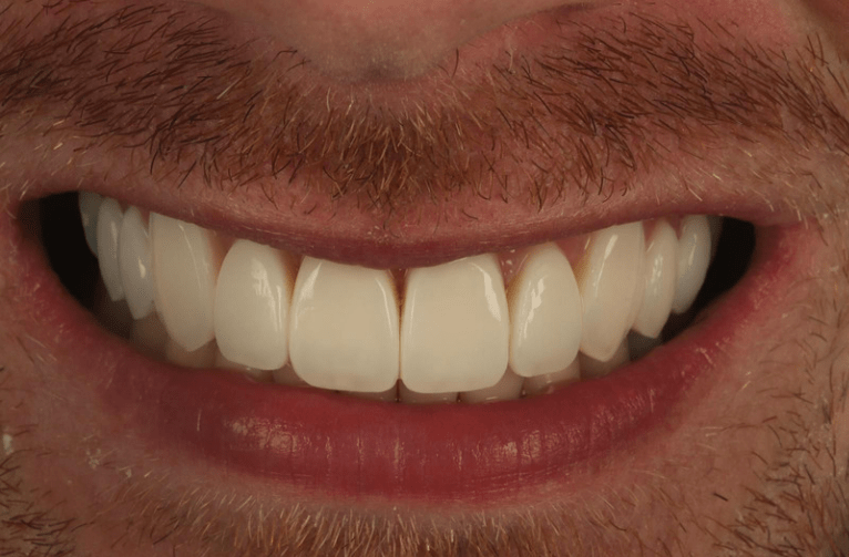 After -Visage Dental