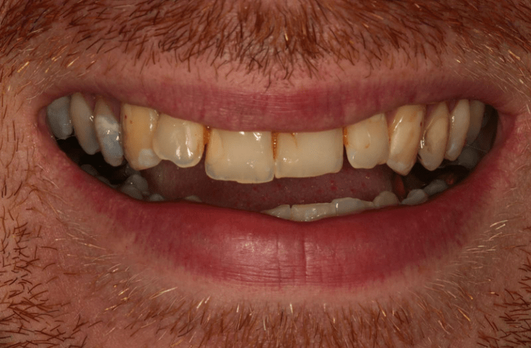 Before - Visage Dental