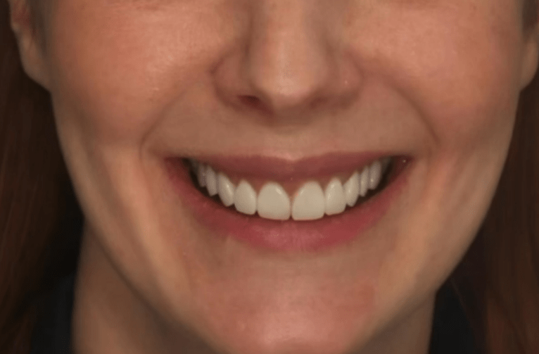 After -Visage Dental