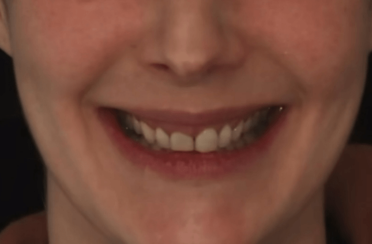 Before - Visage Dental