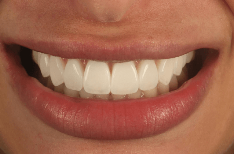 After -Visage Dental