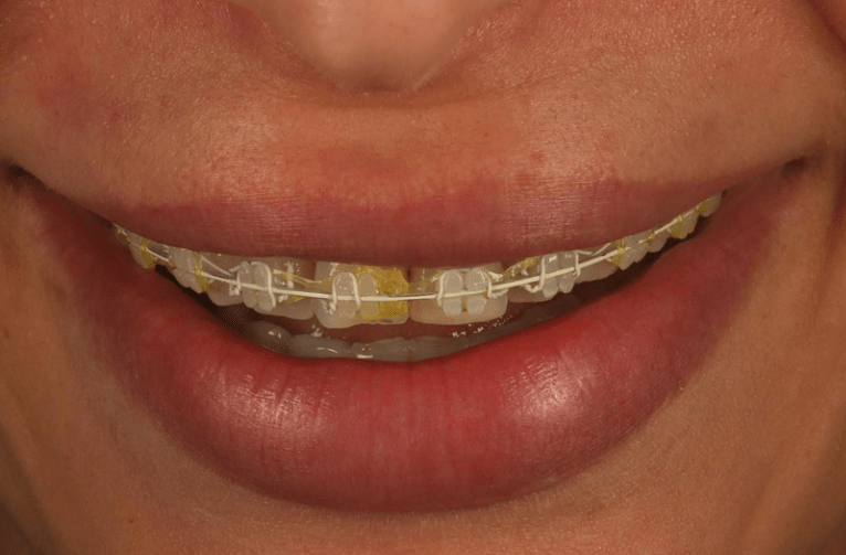 Before - Visage Dental