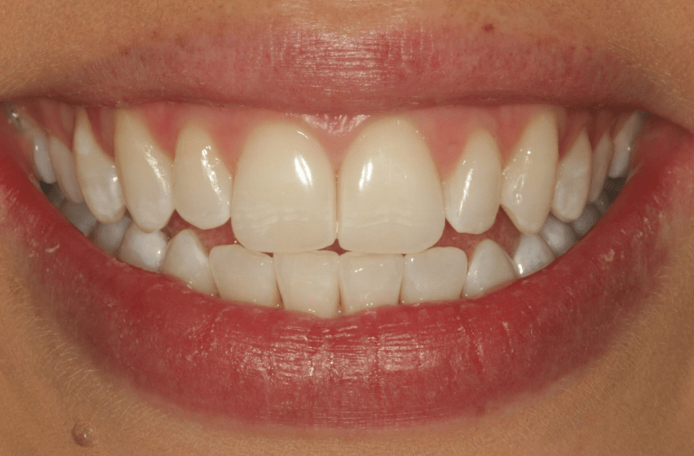 After -Visage Dental