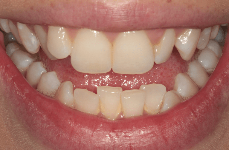 Before - Visage Dental