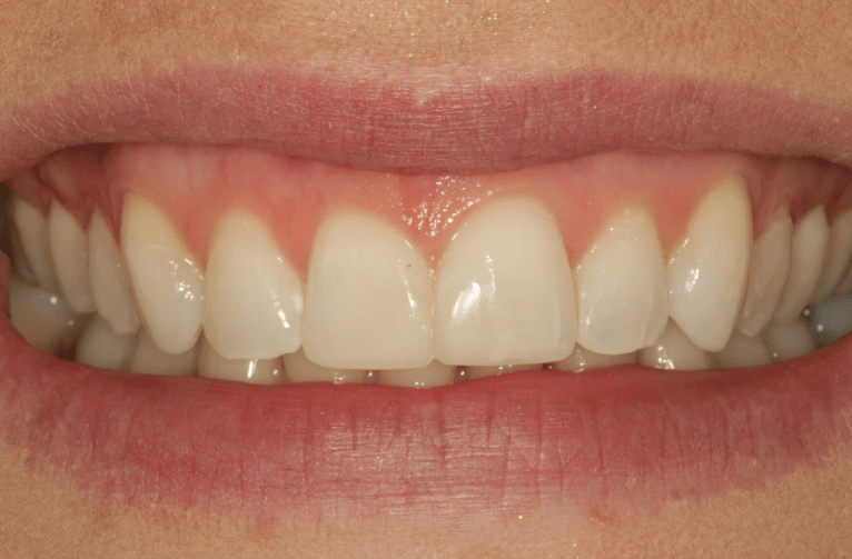 After -Visage Dental