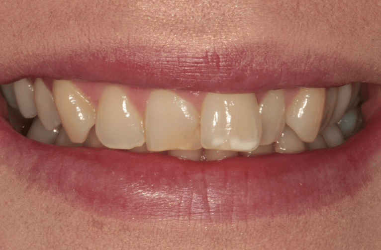 Before - Visage Dental