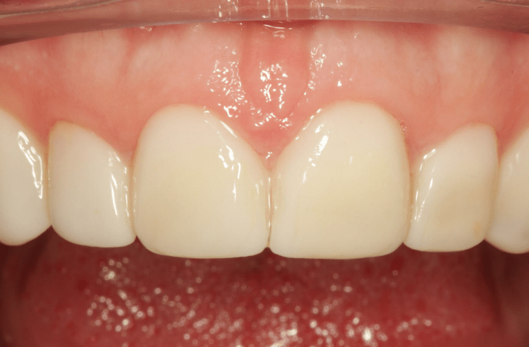 After -Visage Dental