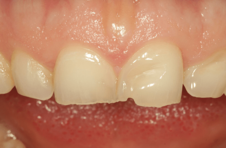Before - Visage Dental