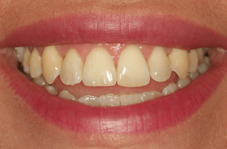 After -Visage Dental