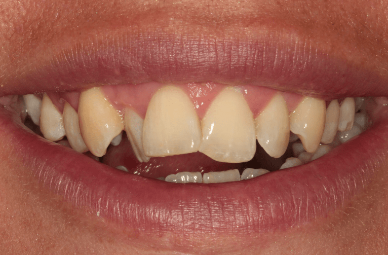 Before - Visage Dental